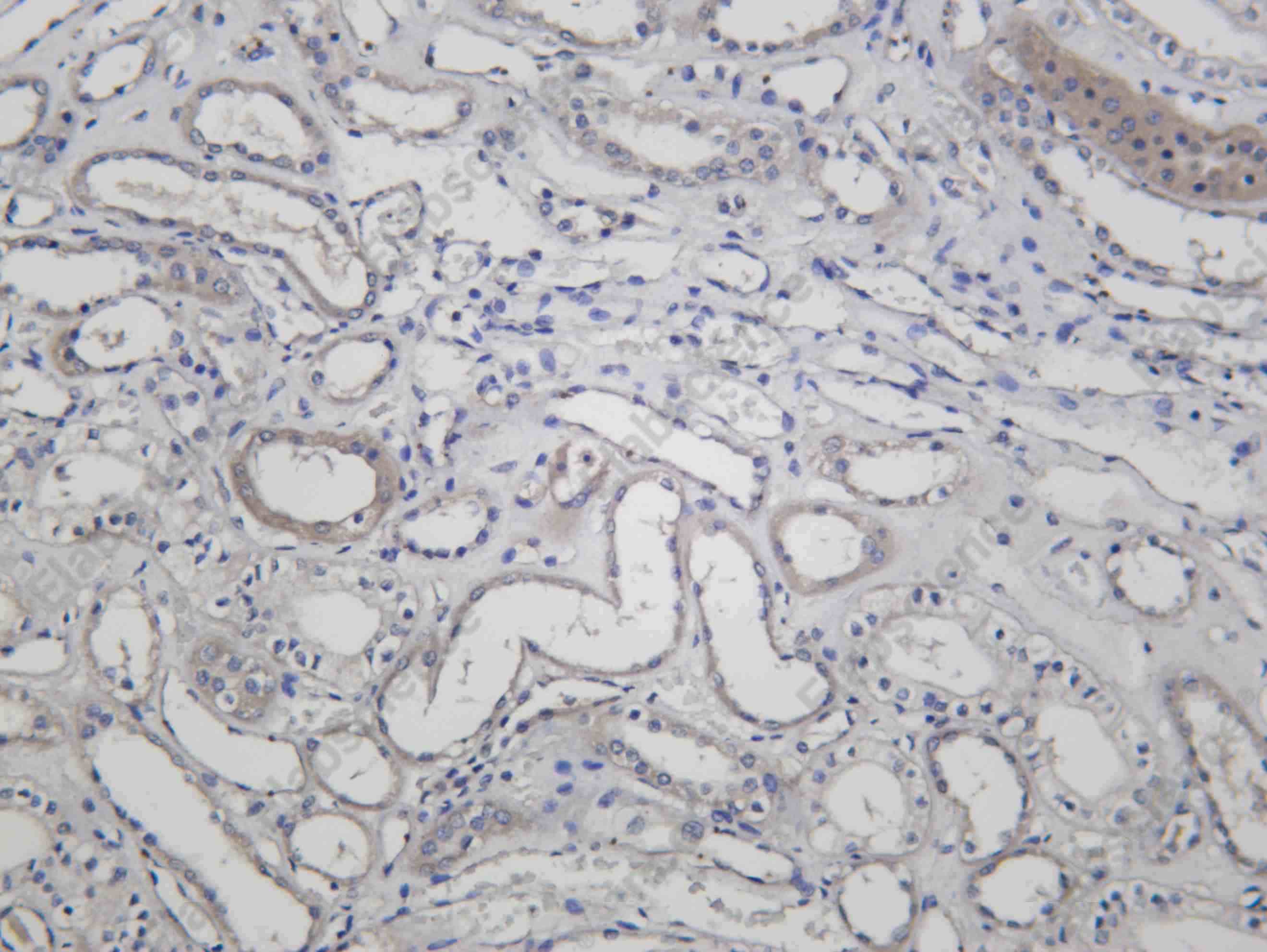 Recombinant KDM5A Monoclonal Antibody - 1