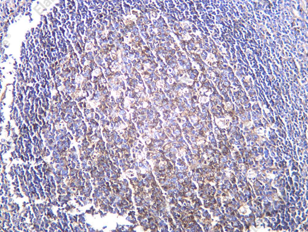 Recombinant IgG Monoclonal Antibody - 1