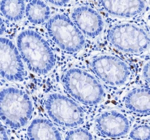 Recombinant IGJ Monoclonal Antibody-searchlist-1