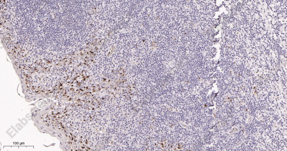 Recombinant Cyclin D1 Monoclonal Antibody - 2