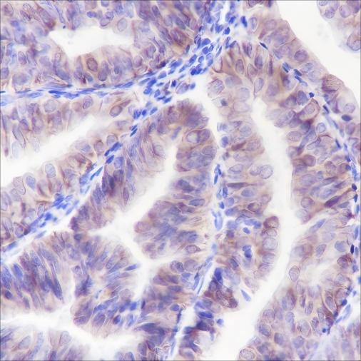 Recombinant ALOX15 Monoclonal Antibody-searchlist-1