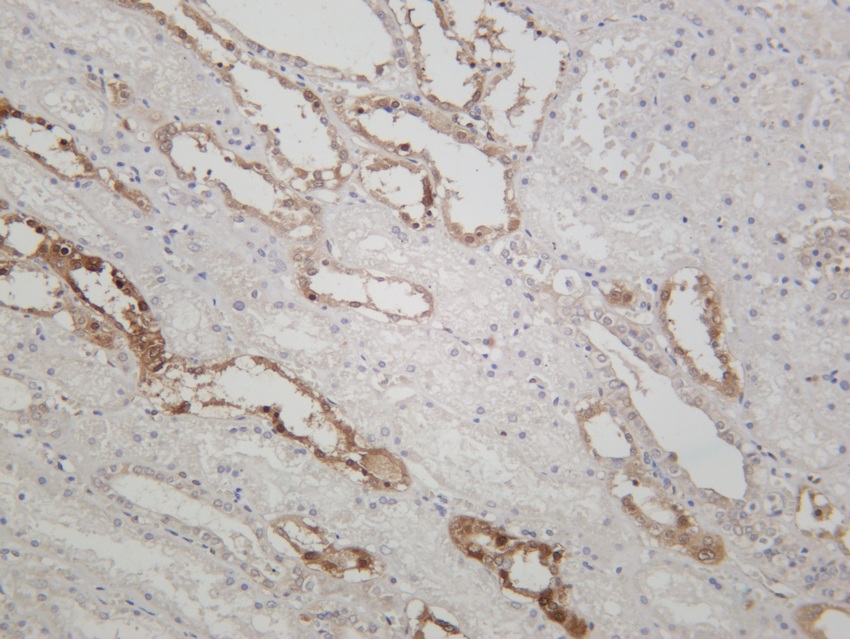Recombinant NQO1 Monoclonal Antibody - small - 5