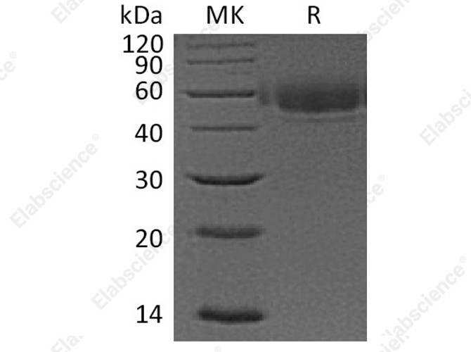Recombinant Human VSIG4 Protein (His Tag) - 1