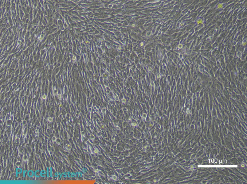 Human Adipose-derived Mesenchymal Stem (Primary cell immortalization) Cell Complete MediumHuman Adipose-derived Mesenchymal Stem (Primary cell immortalization) Cell Complete Medium - 3