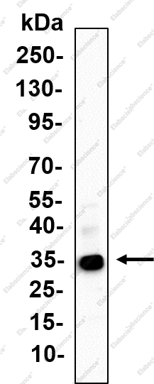 Recombinant p35 Monoclonal Antibody - 2