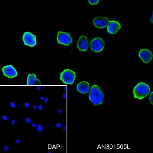 Recombinant Cystatin A Monoclonal Antibody - small - 2