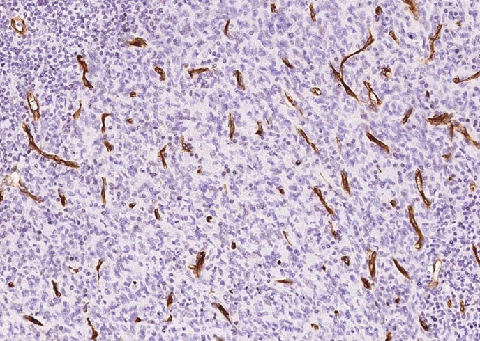 Nestin/NES Monoclonal Antibody - small - 3