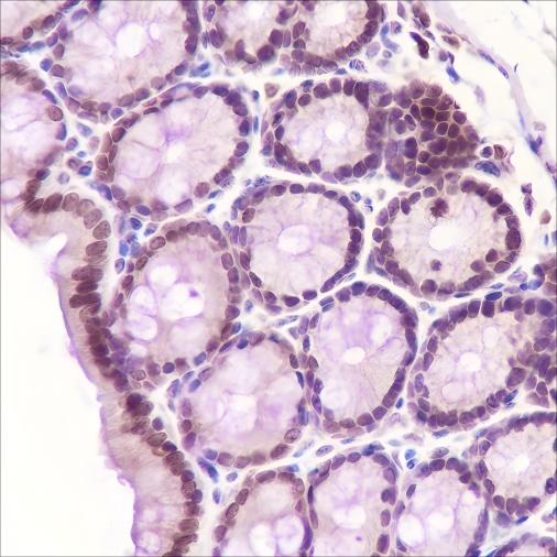 Recombinant CDK8 Monoclonal Antibody - small - 3