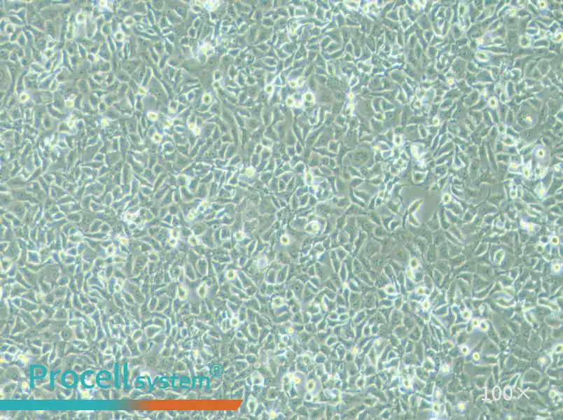 KYSE-450 Cell Complete Medium - 3