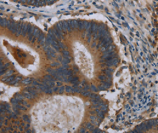 MAP3K11 Polyclonal Antibody - 2