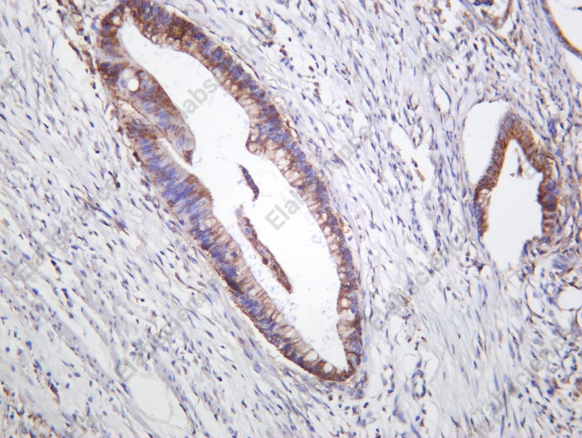 Recombinant Phospho-mTOR (Ser2448) Monoclonal Antibody - 4