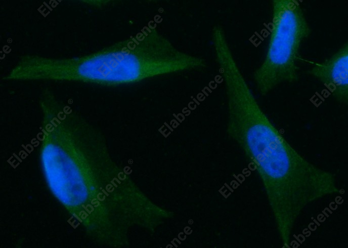 ARD1 Monoclonal Antibody - 1