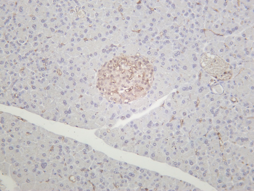 Recombinant CD38 Monoclonal Antibody - 3