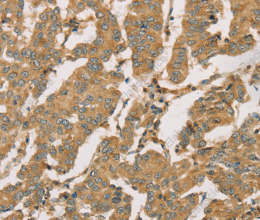 DMRT3 Polyclonal Antibody - 3