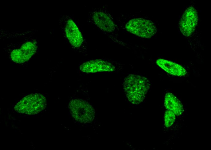 Histone H3 Monoclonal Antibody-searchlist-1