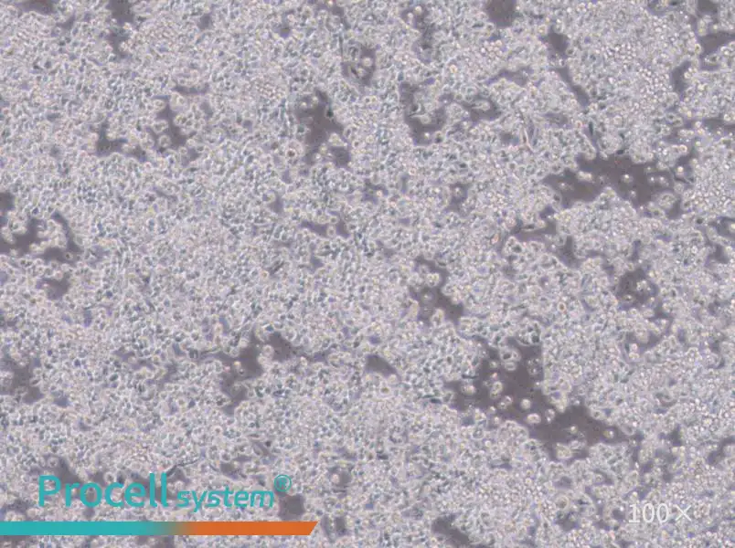 Hce-8693 Cell Complete Medium - 1