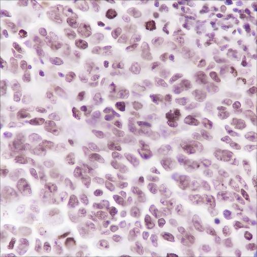 Recombinant Histone H3 (Mono Methyl Lys36) Monoclonal Antibody - small - 4