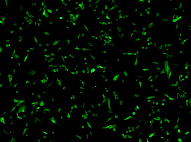 MDA-MB-231-GFP (DMEM) Cell Complete Medium - small - 3
