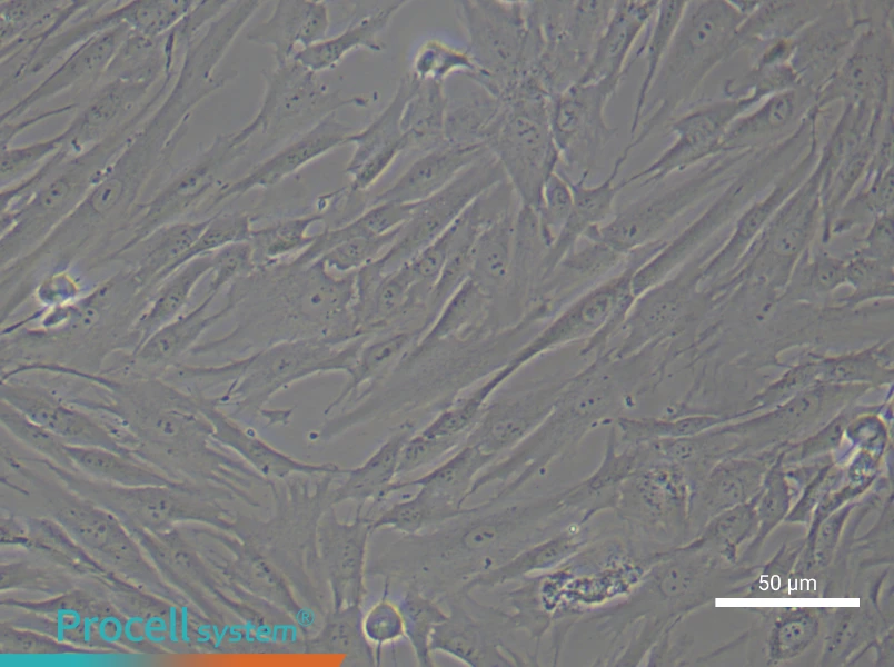 Human Gingival Fibroblast Complete Medium - 6