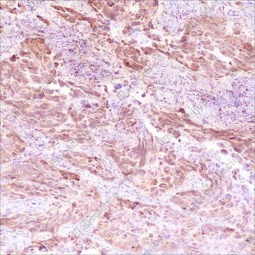 Recombinant Phospho-S6 Ribosomal Protein (Ser235, Ser236) Monoclonal Antibody - 3