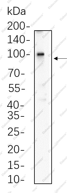 Recombinant Phospho-β Catenin (Thr41, Ser45) Monoclonal Antibody - 1