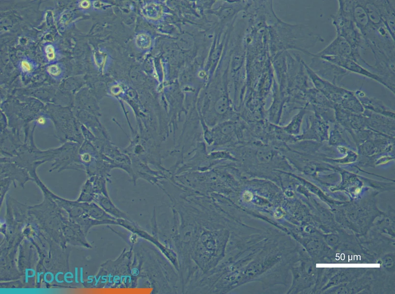 Mouse Microvascular Pericytes - 5