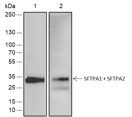 Recombinant SFTPA1+SFTPA2 Monoclonal Antibody-searchlist-1