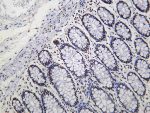 Recombinant MACROH2A1 Monoclonal Antibody - 1