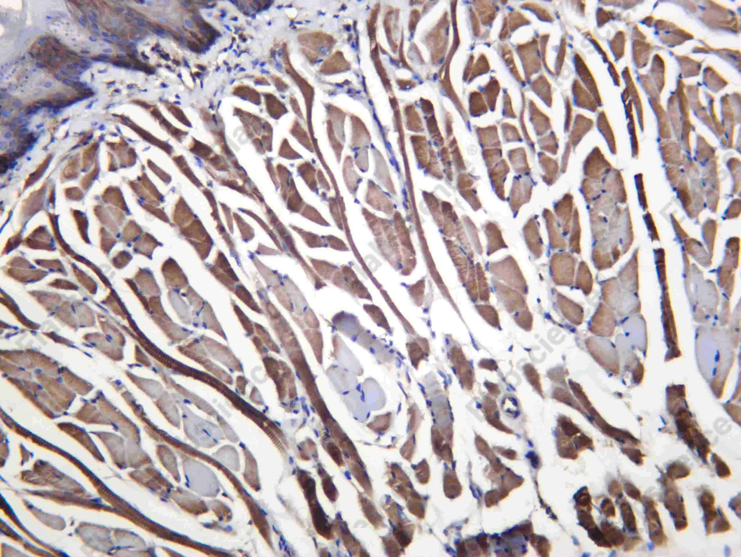 Recombinant Alpha skeletal muscle Actin Monoclonal Antibody - 2