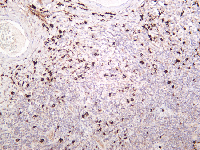 Recombinant Bax Monoclonal Antibody - small - 7