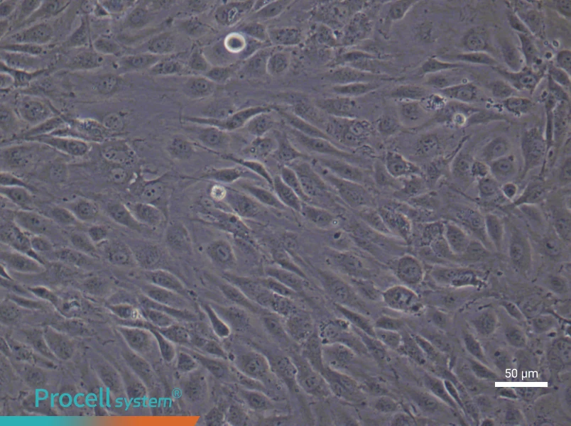 Human Pulmonary Microvascular Endothelial (Primary cell immortalization) Cell Complete MediumHuman Pulmonary Microvascular Endothelial (Primary cell immortalization) Cell Complete Medium - 4