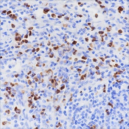 Recombinant CD15/SSEA1 Monoclonal Antibody-searchlist-1