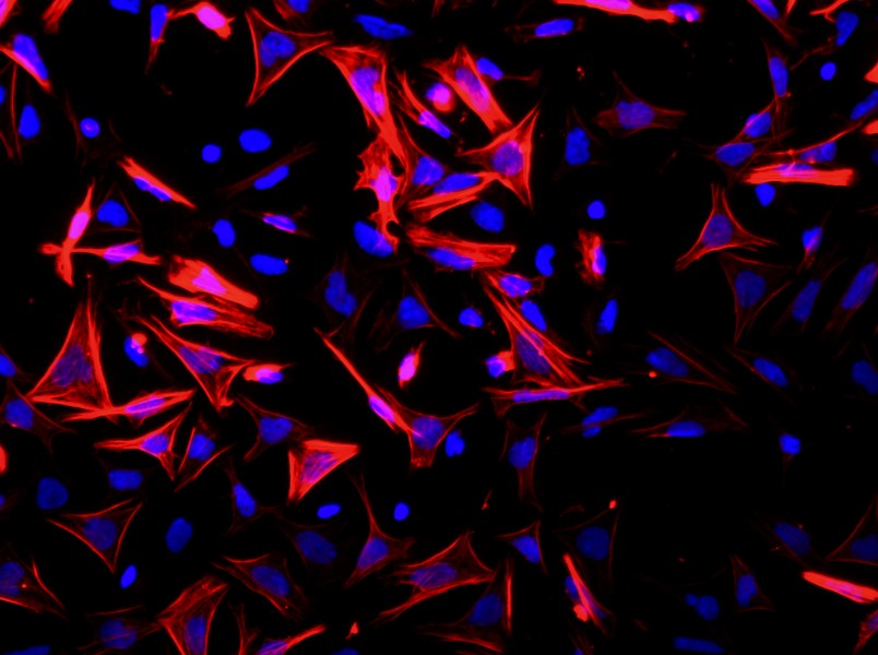 Mouse Small Intestine Smooth Muscle Cell Complete Medium - 2