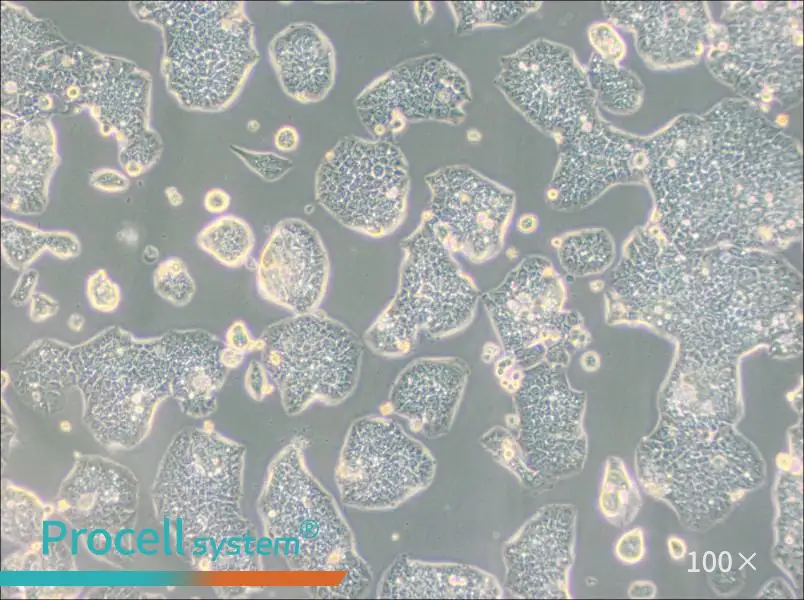 NCI-H1944 Cell Complete Medium - 1
