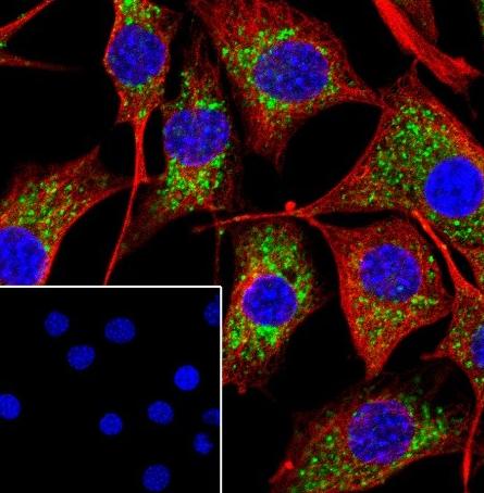 Recombinant Rab7 Monoclonal Antibody - small - 6