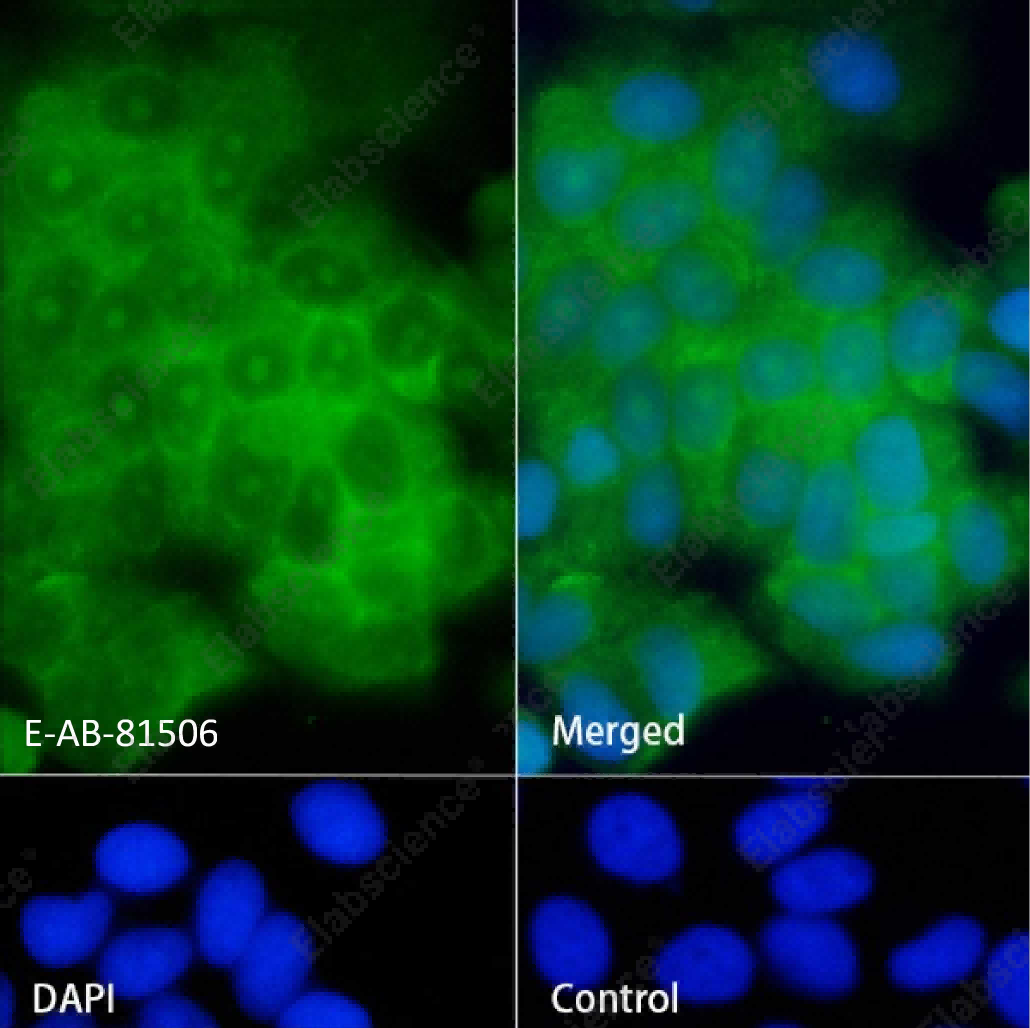Recombinant LINE 1 ORF1p Monoclonal Antibody - 2