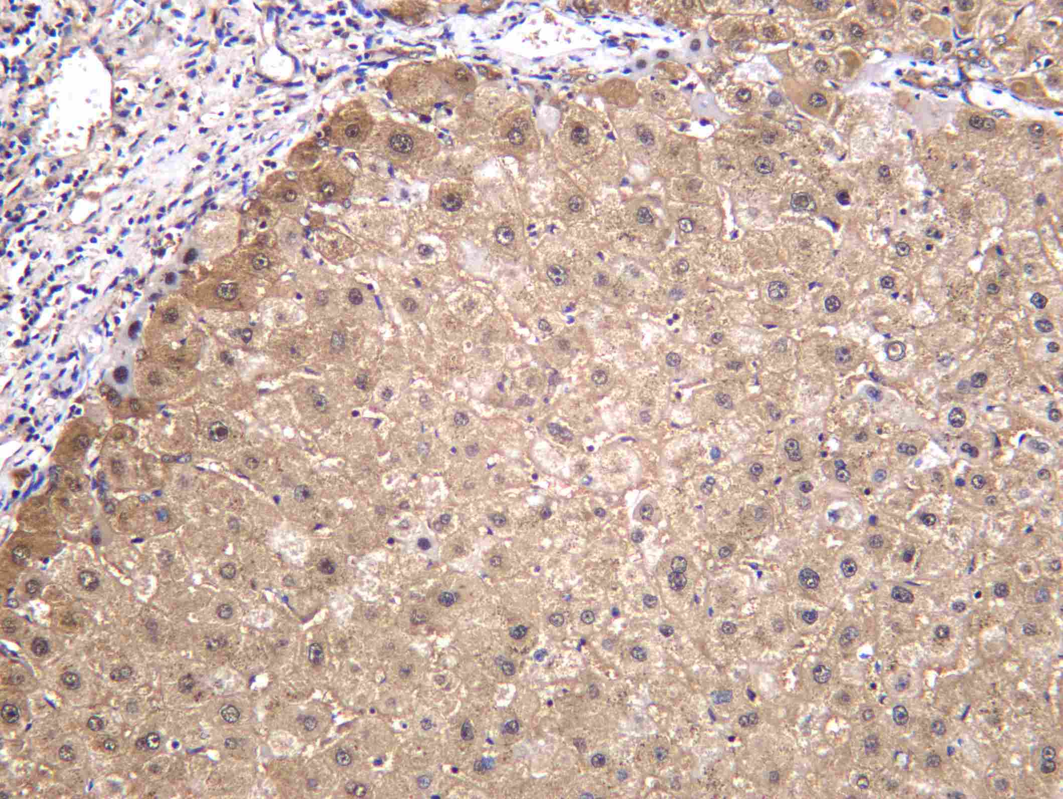 Recombinant GSHB Monoclonal Antibody - 2