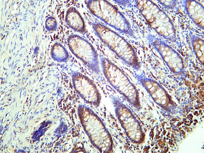 Recombinant SQSTM1/p62 Monoclonal Antibody - 6