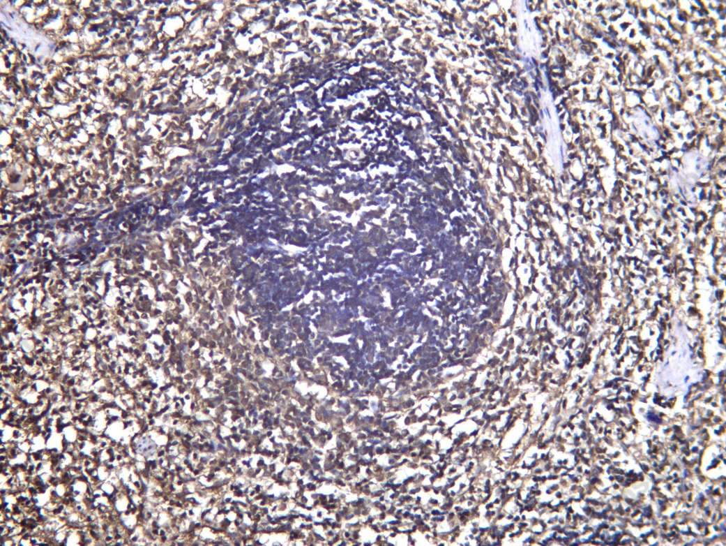Recombinant PSMB9 Monoclonal Antibody - 4