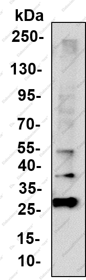 Recombinant PTTG1 Monoclonal Antibody - 5