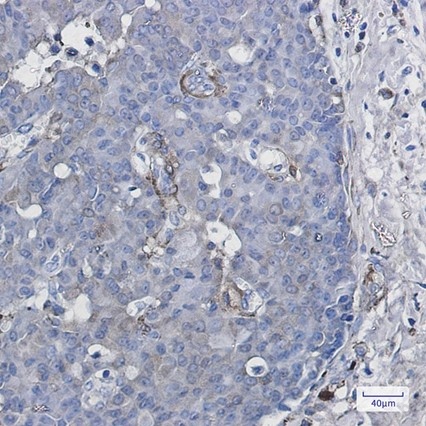 Recombinant CYP1B1 Monoclonal Antibody - 2