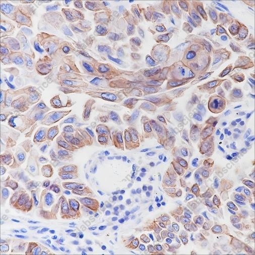 Recombinant Keratin 6 Monoclonal Antibody - 4