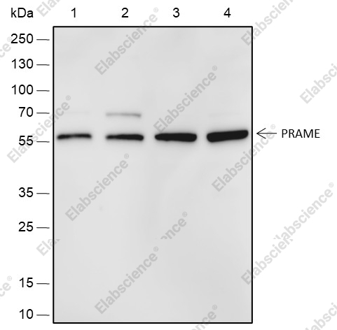 Recombinant PRAME Monoclonal Antibody - 1