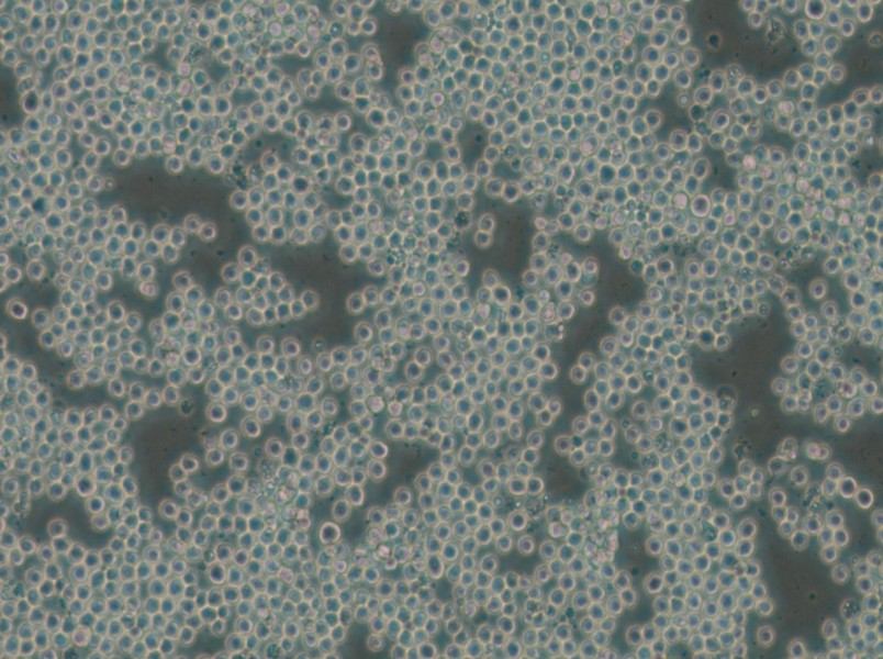 P3/NSI/1-Ag4-1 [NS-1] Cell Complete Medium - small - 5