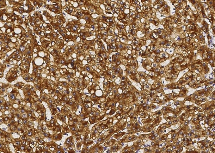 Recombinant ASGPR1 Monoclonal Antibody - small - 2