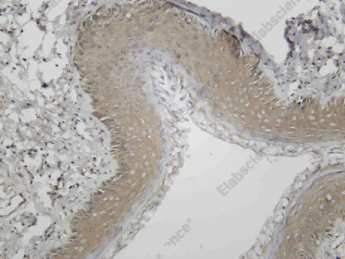 Recombinant Raf-1 (Phospho Ser259) Monoclonal Antibody - 2