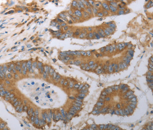 SLC22A6 Polyclonal Antibody - 2