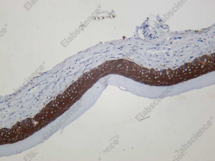 Recombinant 14 3 3σ Monoclonal Antibody - 2
