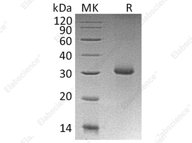 Recombinant Human RGMA Protein (E.coli, His Tag) - 1