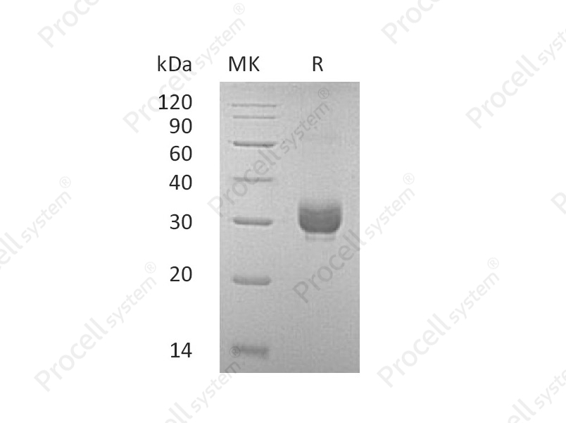 Noggin/NOG (C-6His), Mouse, Recombinant